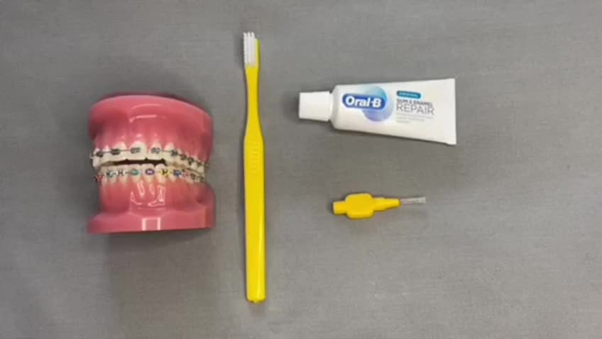Fixed brace brushing instructions